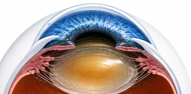 cataract eye image