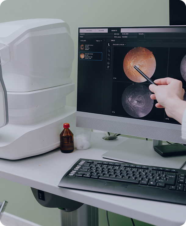 How do we diagnose AMD?